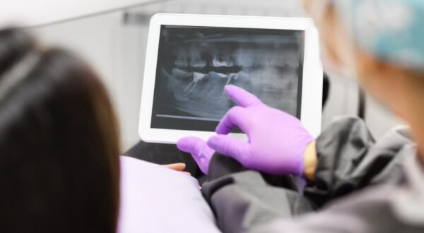 Advanced dental X-ray technology at Friedman Dental, highlighting the practice’s dedication to utilizing modern diagnostic tools for optimal patient care.