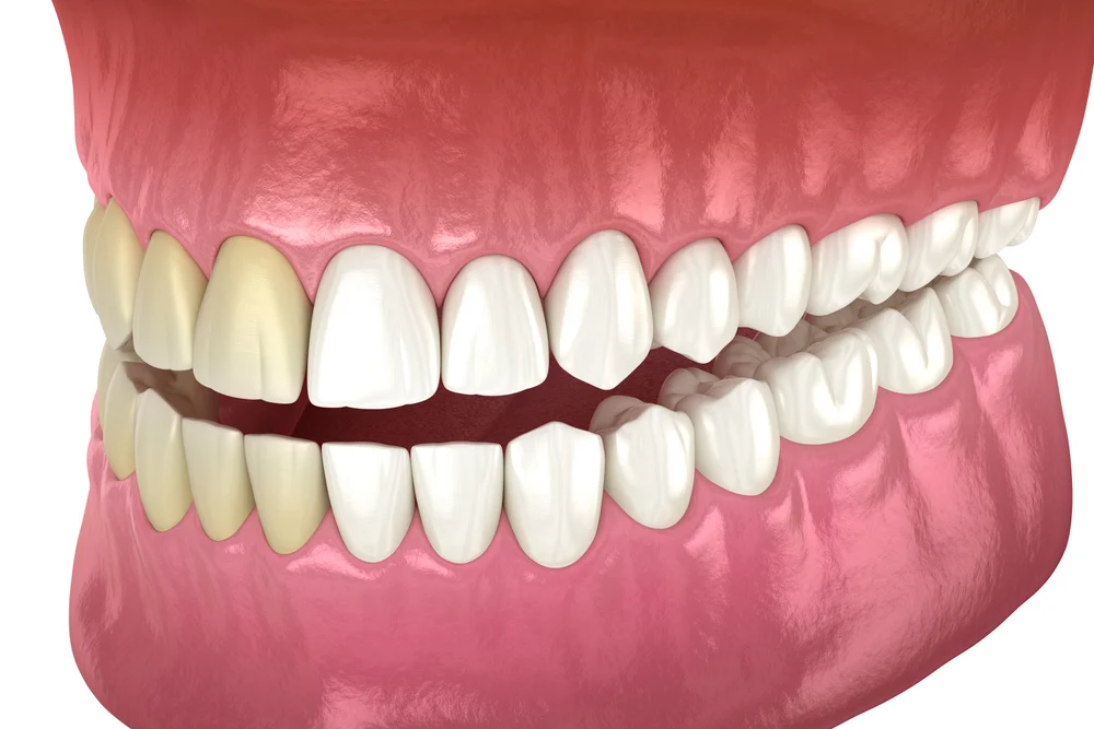 Cosmetic Dentistry 