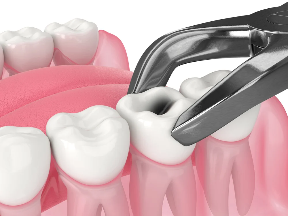 Emergency Dentistry 