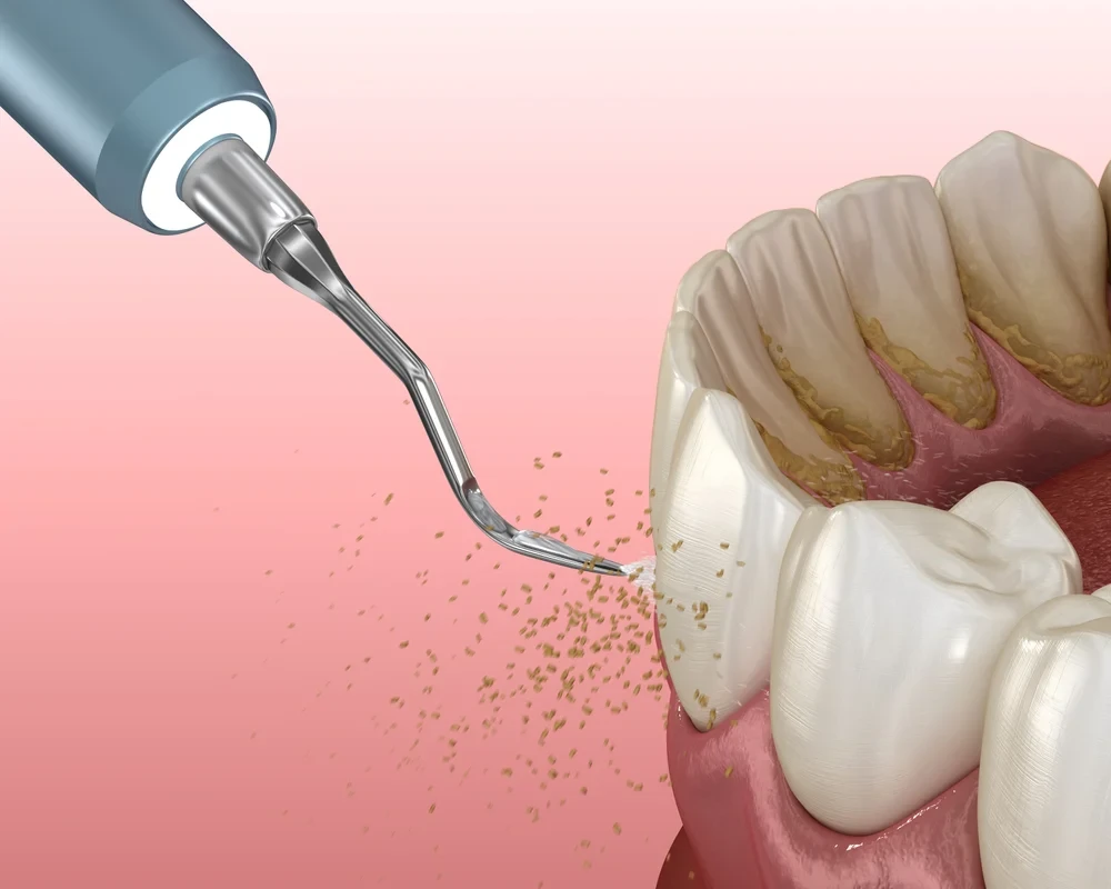 Family Dentistry 