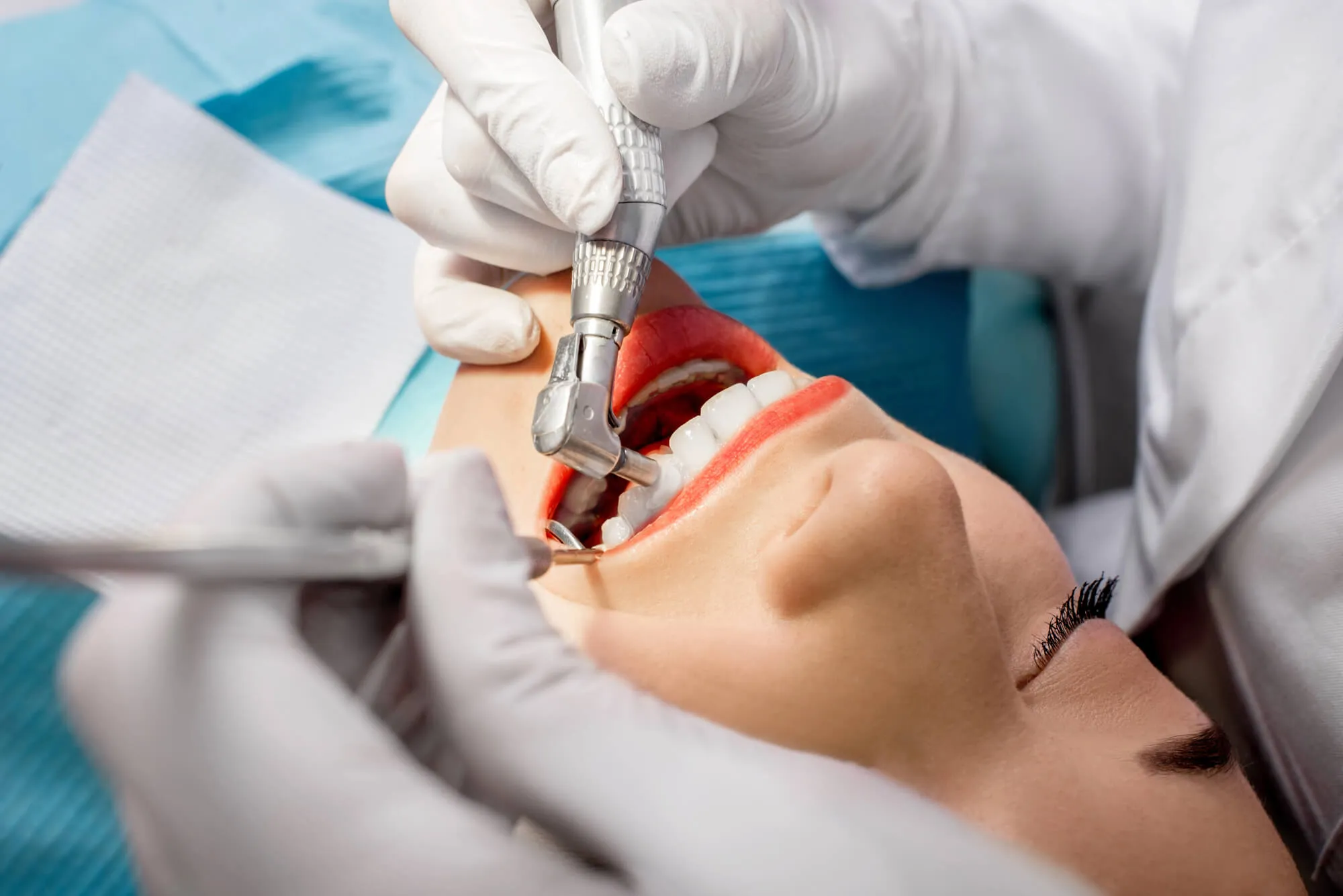 affordable miami dental cleaning