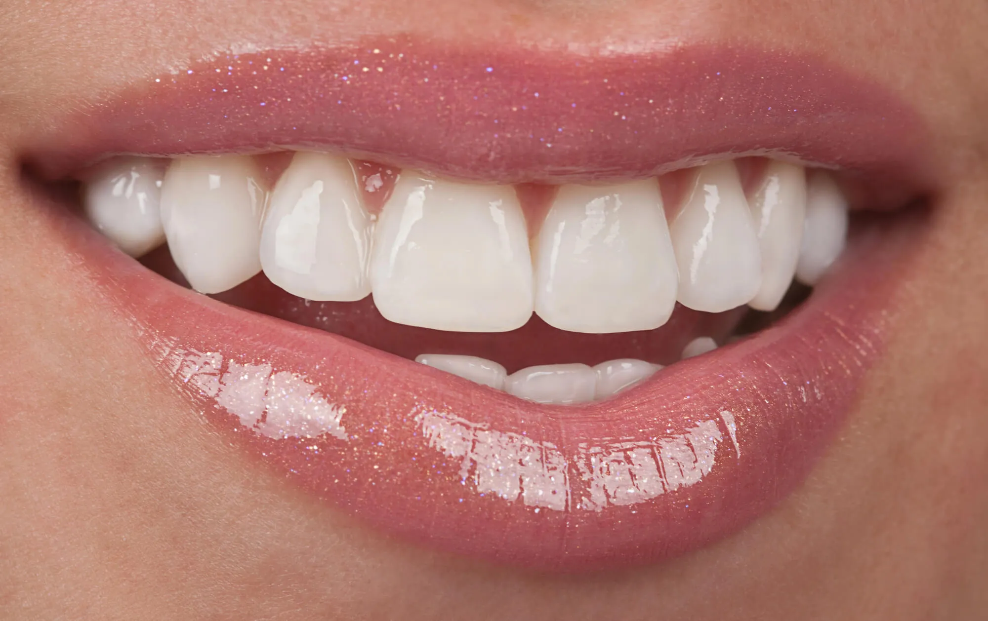 smiling after getting same day veneers miami
