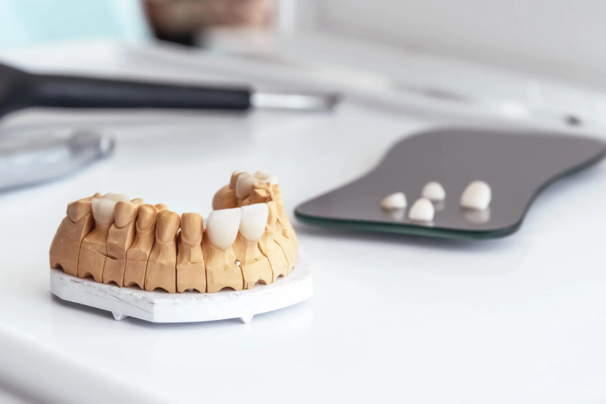Porcelain Veneers Miami on a teeth model