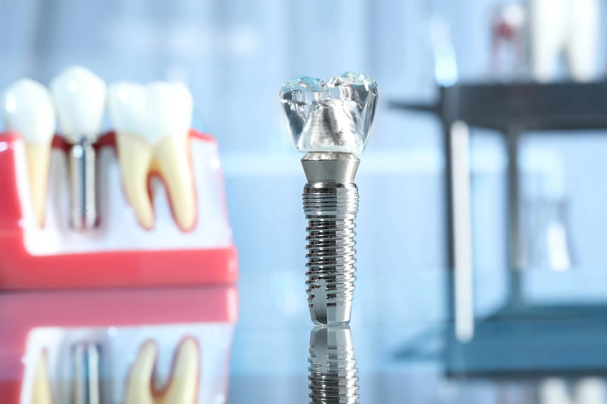 model for the Best Dental Implants in Miami