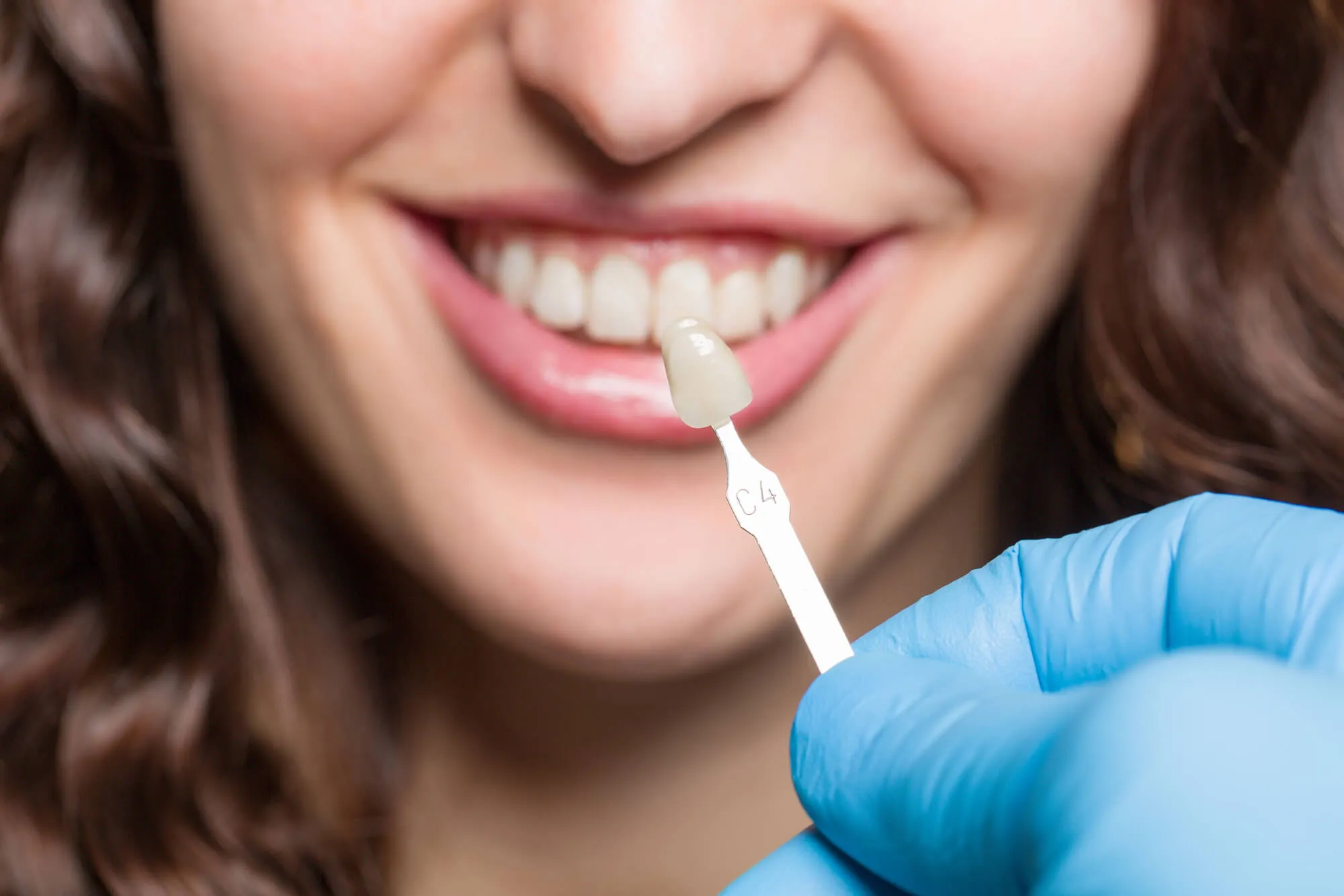 cosmetic-dentist-coral-springs-chooses-a-shade-for-patients-teeth