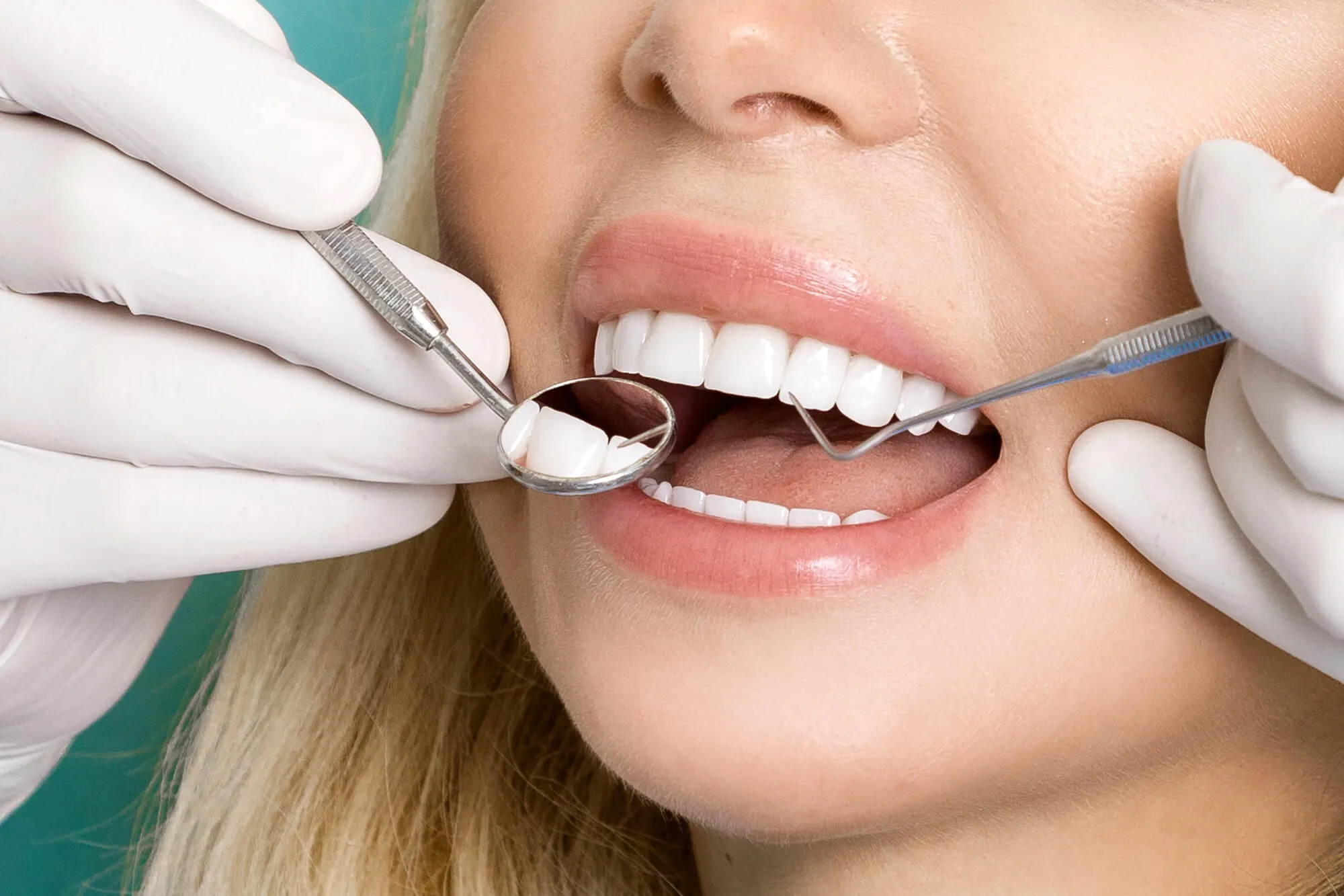 patient-preparing-for-her-dental-implants-coral-springs