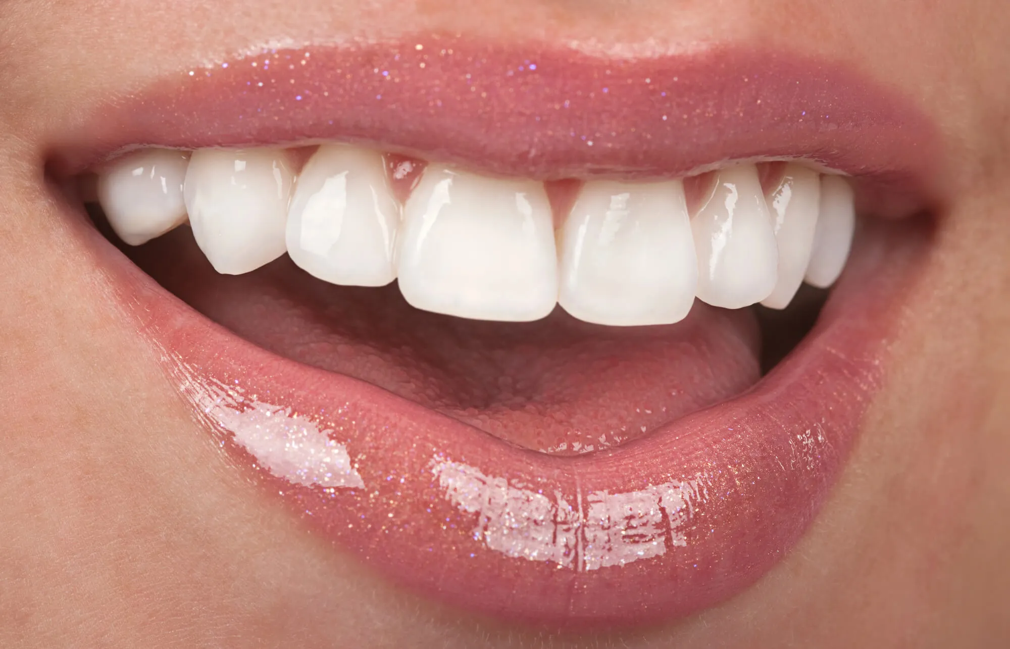 patient-showing-her-cosmetic-dentist-coral-springs-her-new-smile