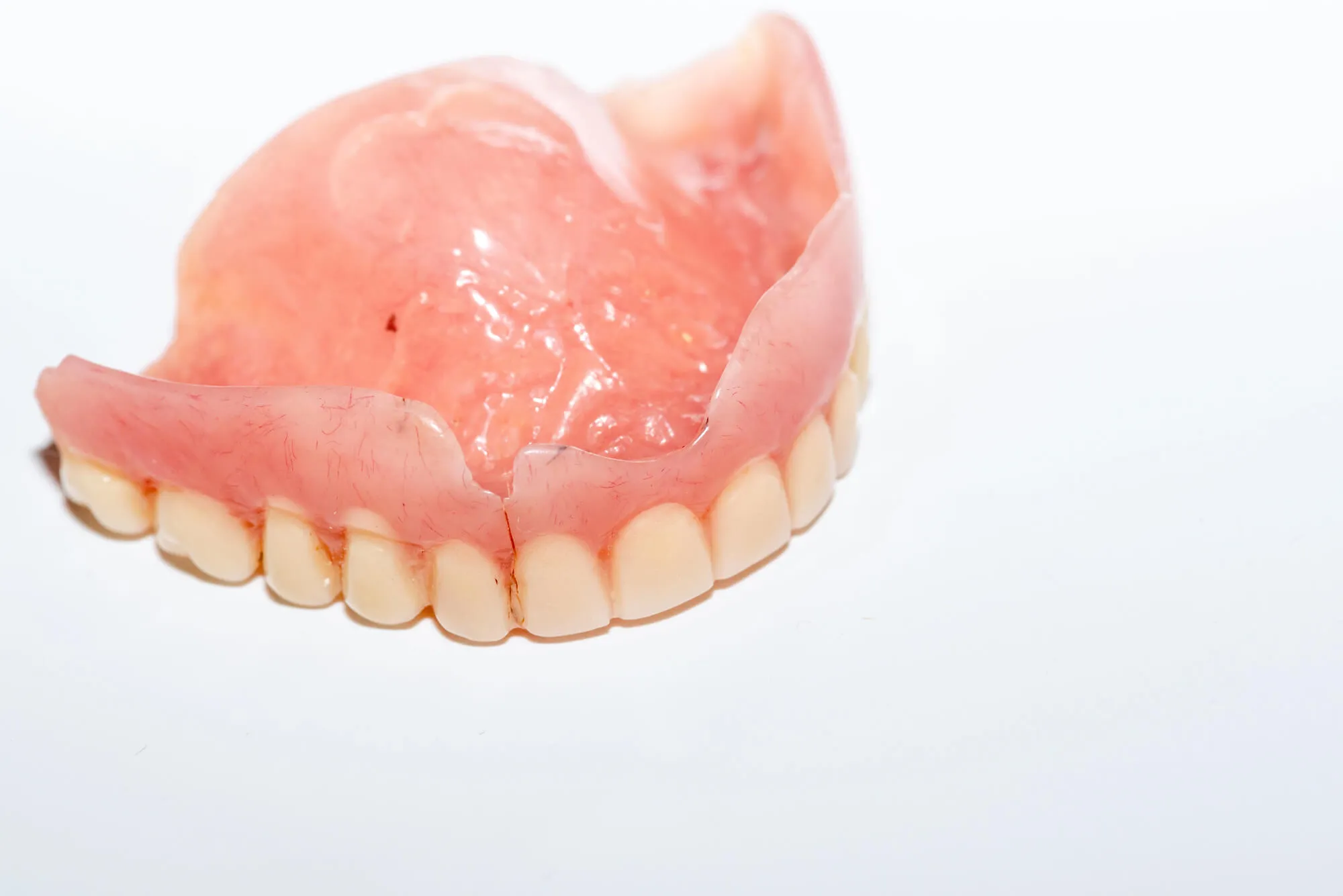 upper arch dentures from a dentist north lauderdale