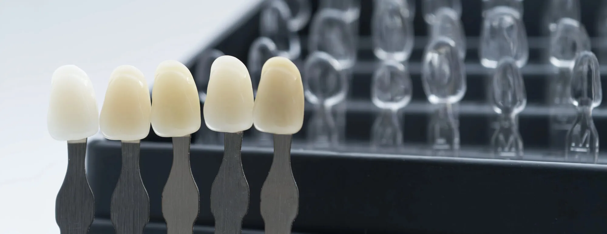 Veneers Miami shade guide