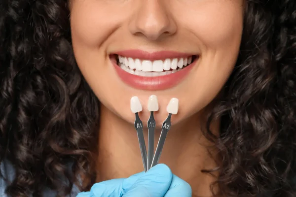 choosing a shade for her Veneers Miami