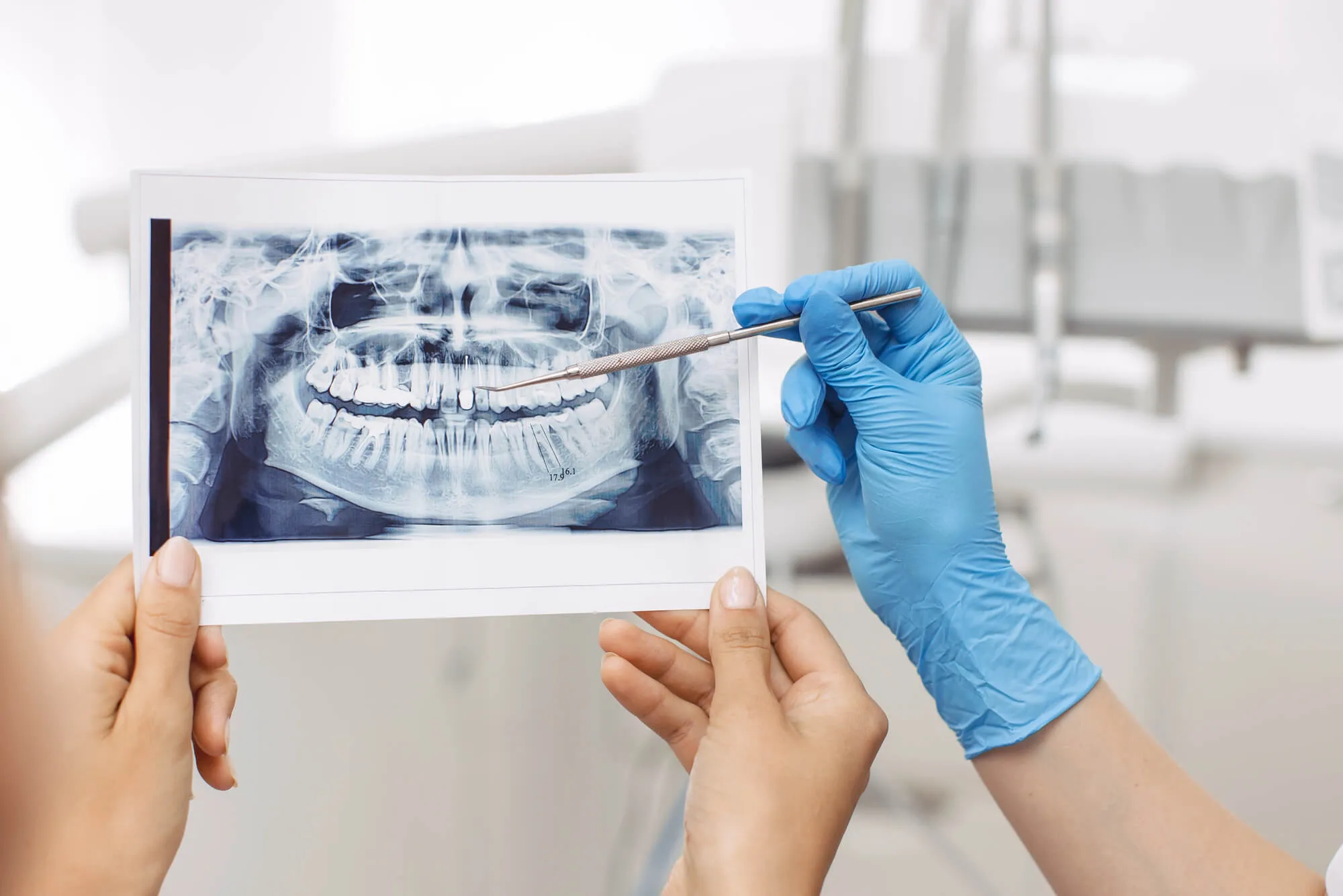 coral springs dentist accepting humana looking at xray image