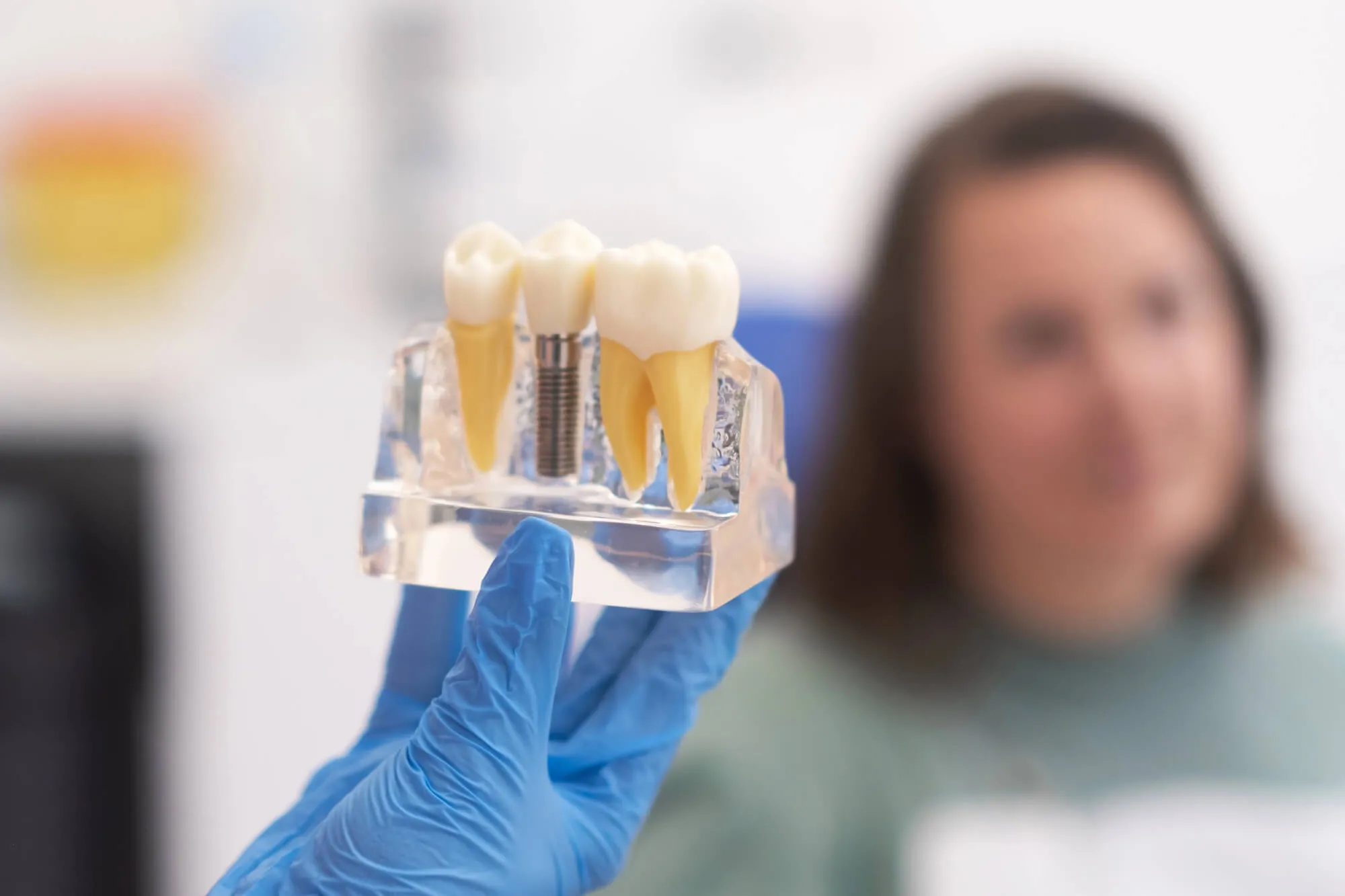 dental implants tamarac humana model