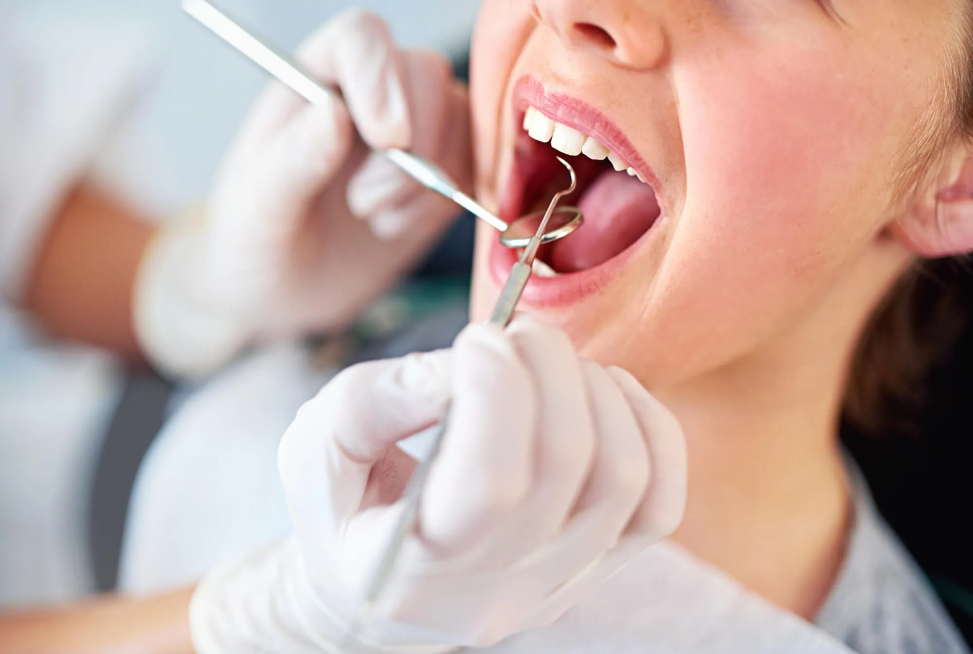 dentist coral springs performing dental exam