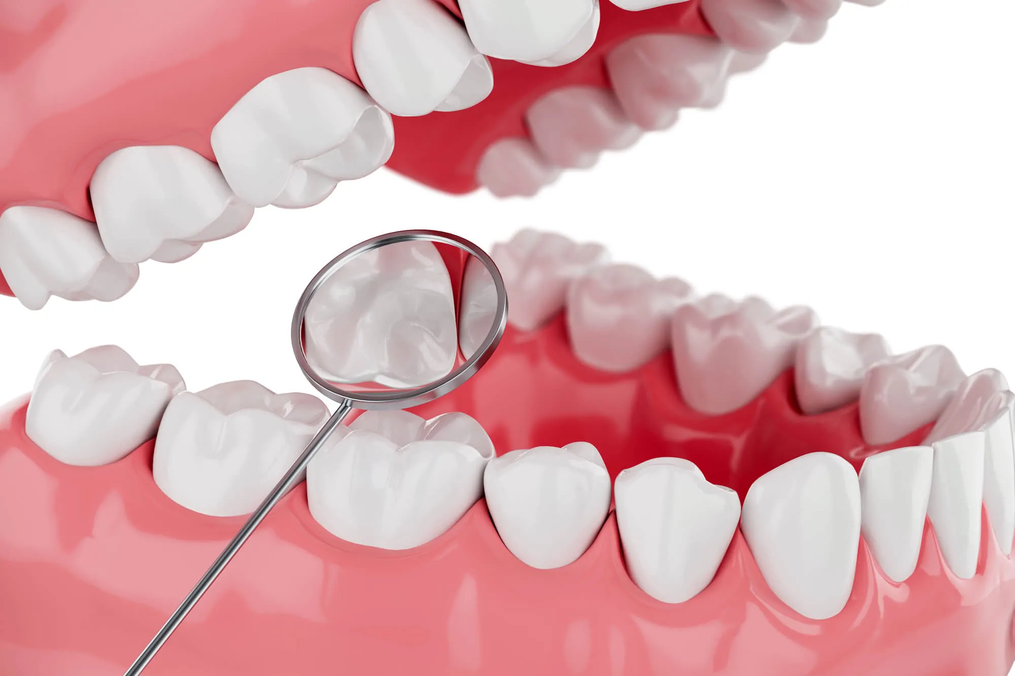 family dentist coral springs shows teeth model
