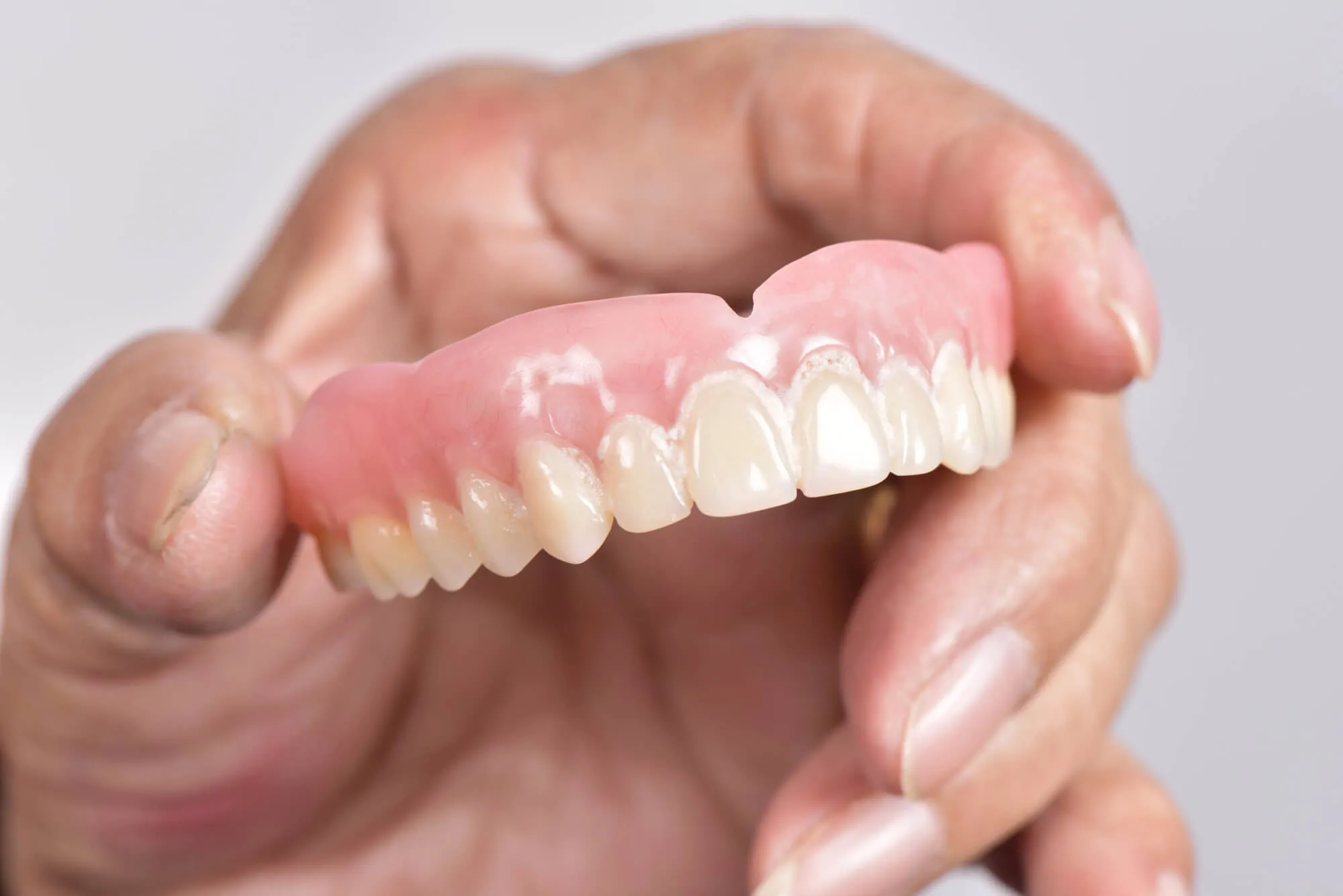 holding dentures tamarac