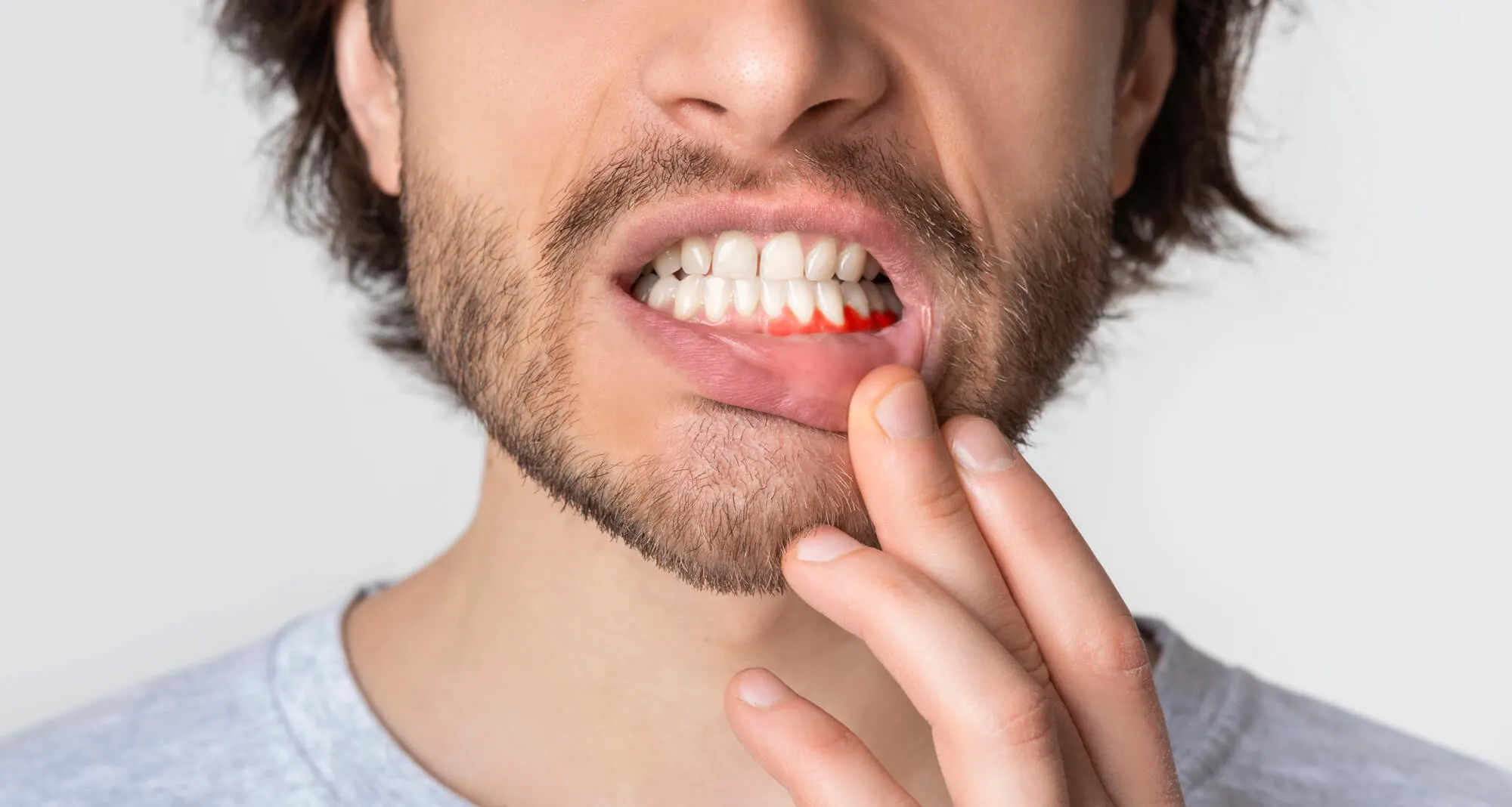 man in pain needs to see a dentist lauderhill